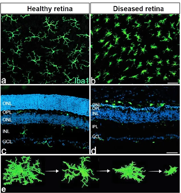 Figure 3: Microglia morphology in health and disease.  Flat-mounts (a &amp; b) and cross- cross-section (c &amp; d) images of Iba1-positive microglial cells in retinas from wild-type (a &amp; c)  and Fam161a-deficient  mouse  model  of  Retinitis  Pigmento