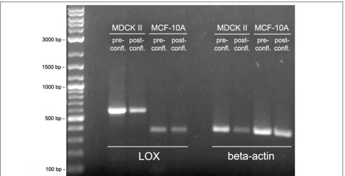 Figure  13. Expression of  LOX  mRNA in  MDCK  II and  MCF-10A cells as detected by RT-PCR  with  gene-specific primers.