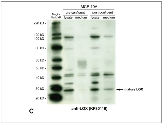 Figure  15. Detection  of LOX protein by western blot analysis in cell lysates and media fractions of (A +  B) MDCK II and (C) MCF-10A cells.