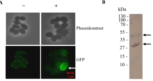 Abb. 3.9: In  vivo  Lokalisation  des  N-terminal  markierten  GFP-CglK-Proteins  und  Western Blot  des  C-terminal markierten CglK-Strep-Proteins in C