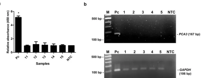 Figure 7: The MNP-based PCR coupled with colorimetric assay of PCA3 detection from urine of healthy  controls