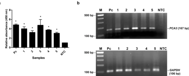 Figure 5: The MNP-based PCR coupled with colorimetric assay of PCA3 detection from urine of PCa  patients