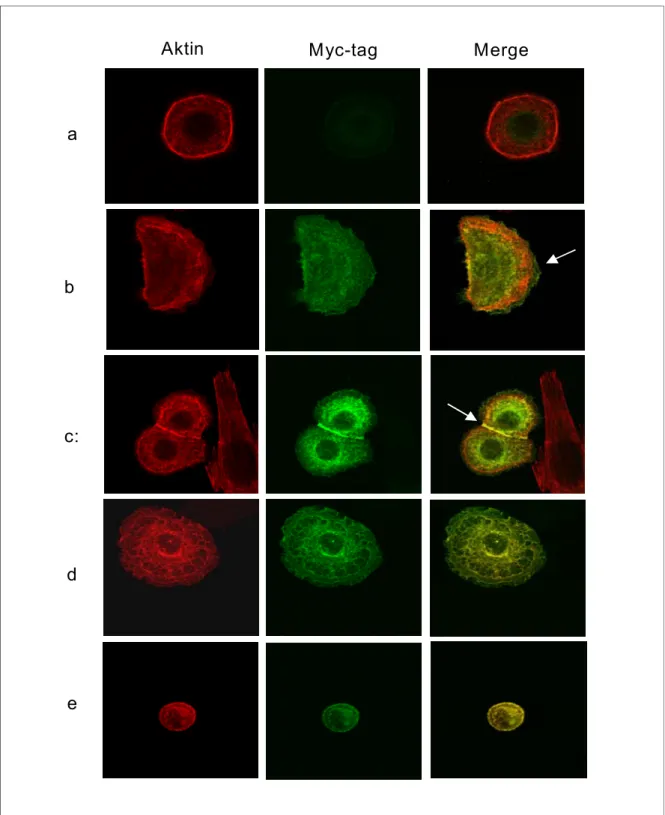 Abbildung 3.4: Bilder von Immunfluoreszenzfärbungen transient transfizierter humaner  Keratinozyten mit TRITC-Phalloidin gegen polymerisiertes Aktin mit einem Antikörper gegen  Myc-Tag (Klon 9B11) und beide Bilder übereinander gelegt (gelbe Färbung bei  Ko