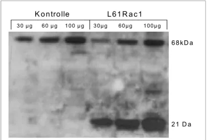 Abbildung 3.5: Western Blot Analyse von Kontrollkeratinozyten und mit L61Rac1  transfizierten Zellen