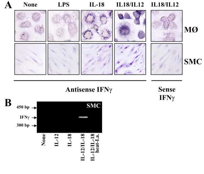 Figure 8: IL-18 induces IFNγ expression in human monocytes and vascular smooth muscle  cells