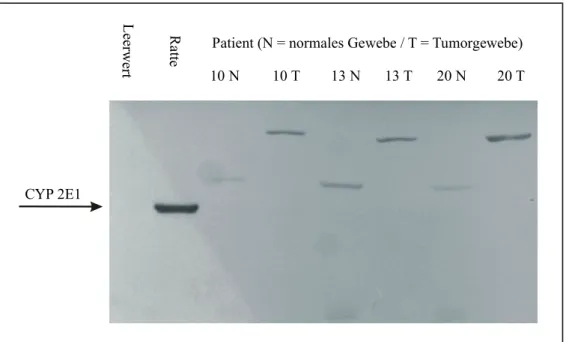 Abb. 4: Western-Blot nach vorangegangener SDS-PAGE von Mikrosomen aus humaner Niere und Rattenleber