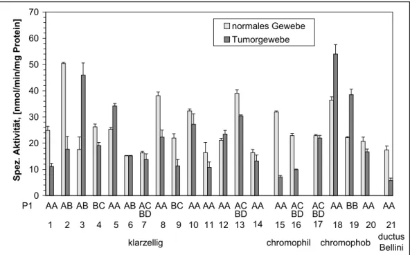 Abb. 8: Spezifische Aktivität der hGSTP1-1 gegenüber VP in normalem Gewebe und in Tumorgewebe in Abhängigkeit der Tumorcytomorphologie und der  GSTP1-Allelvarianten
