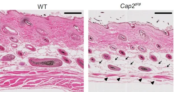Figure  3.6:  Loss  of  CAP2  indicates  sarcopenia.  1  year  old  skin  paraffin  sections  from Cap2 gt/gt  and WT mice were stained with H &amp; E