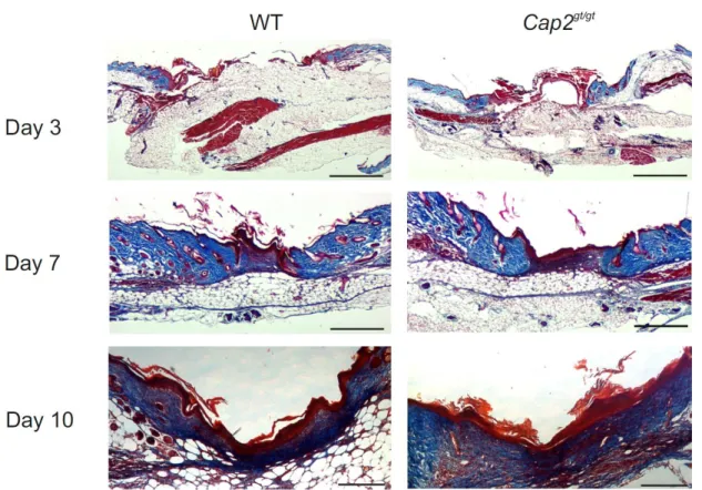 Figure  3.9:  Masson's  trichrome  staining  of  the  wounds  revealed  no  significant  difference in collagen content (blue) in mutant animals after wounding