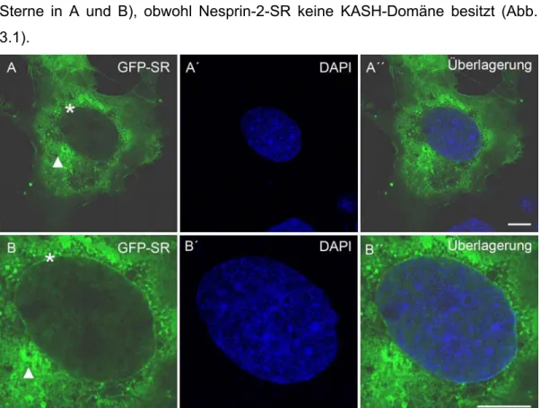 Abb. 3.2: GFP-Nesprin-2-SR lokalisiert in COS7 Zellen im Zytoplasma und entlang der  Kernmembran