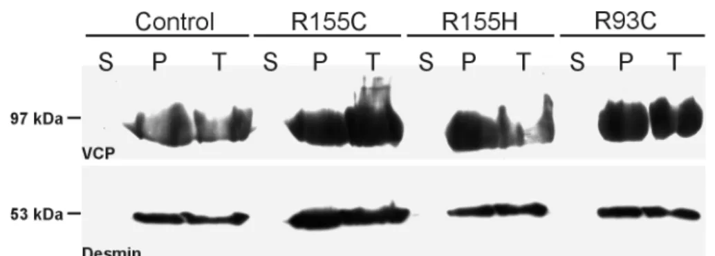 Fig. 7. p97 immunoblot analysis of normal and IBMPFD muscle after differential  centrifugation.