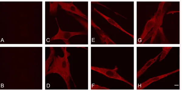 Fig. 9. Confocal immunofluorescence images of IBMPFD (A, C; E and G; R155C)  and normal (B, D, F and H) primary human myoblasts.