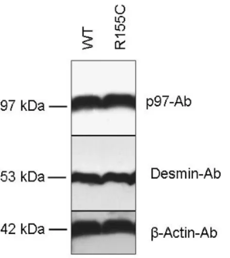 Fig.  10.  Immunoblot  analysis  of  total  protein  extracts  from  cultured  normal  and  IBMPFD (R155C-p97 mutant) primary myoblsts