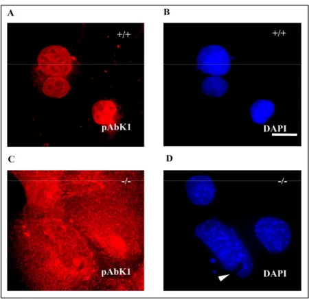 Abb. 3.8 Verteilung von Nesprin-2 in Lamin A/C Knock-out ibroblasten (A, B) In Wildtyp Fibroblasten ist Nesprin-2 am Kern konzentriert, bei den  Lamin  A/C-  Knock-out  Fibroblasten  eine  Umverteilung  des  Nesprin-2  in  das  Zytoplasma  deutlich  erkenn