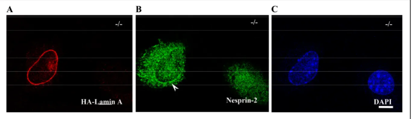 Abb. 3.9 Nesprin-2 Relokalisierung an der Kernmembran in  den  Lamin A/C  Knock-out Fibroblasten durch  die Expression eines HA-Lamin A Fusionsprotein