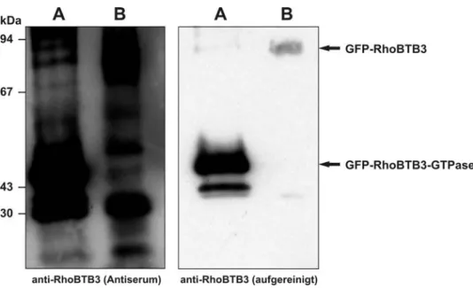 Abbildung 3.1 Antikörperaufreinigung. COS7-Zellen wurden mit Plasmiden GFP-RhoBTB3- GFP-RhoBTB3-GTPase (A) und GFP-RhoBTB3 (vollständige Sequenz; B) transfiziert und die Homogenate mittels  12%-igen SDS-PAGE aufgetrennt