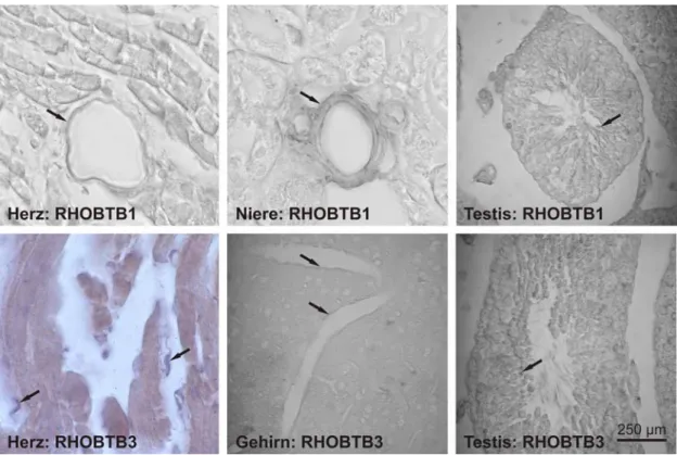 Abbildung 3.3 In situ-Hybridisierung von RHOBTB1 und RHOBTB3 in Mausgeweben. Herz-,  Niere- und Testisschnitte für RHOBTB1 und Herz-, Gehirn- und Testisschnitte für RHOBTB3 wurden  mit spezifischen Digoxigenin-markierten Sonden hybridisiert