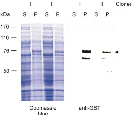 Figure 7B. Analysis of GST-PIP5K fusion protein in cytosol and membrane fractions.  