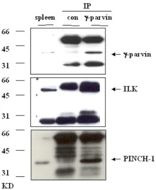 Figure 3.1-8 Coimmunoprecipitation of γ-parvin with ILK and PINCH-1 in spleen lysate. Spleen lysates  were mixed with purified γ-parvin antibody or preimmune serum as a control