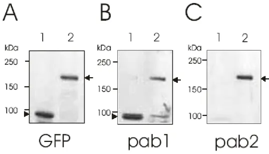 Figure 3.6: Western blot analysis of cell homogenates from COS7 cells transfected with GFP-ABD- GFP-ABD-NUANCE (1) and GFP-Enaptin-165 (2) using the polyclonal antibodies raised against the ABD of Enaptin  (pab1 and pab2)