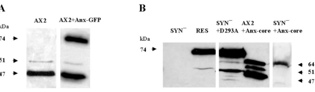 Fig. 4. Expression of annexin-GFP fusion proteins in wild type and mutant cells. Total cellular extracts from D