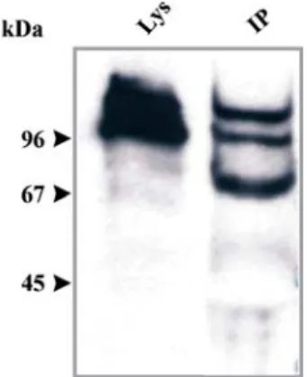 Figure 9: Detection of phosphorylation. Western blot showing phosphorylation of  ddfilamin