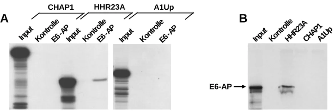Abb. 8:  HHR23A, nicht jedoch CHAP1 und A1Up, binden in vitro an E6-AP. (A) GST-E6-AP bzw
