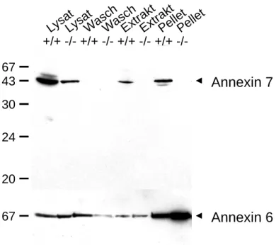 Abb. 3.10: Extraktion von Annexinen aus Leberhomogenat von Wildtyp (+/+)- und Anx7 (-/-) -Maus (-/-)