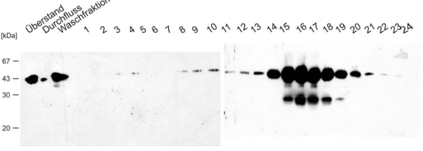 Abb. 3.3: Aufreinigung von SMOC-2 FTST-His über eine Ni-NTA-Säule. 