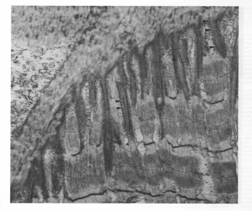 Fig. 1.4. Transmissions Elektronenmikroskop Aufnahme des M. semitendinosus vom  Frosch