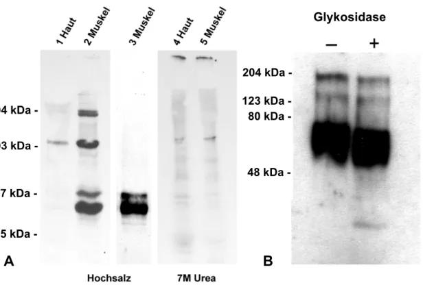 Fig. 2.8: Expression von Kol XXII in Geweben. Immunoblot mit Antikörper R34 auf Gewebeextrakten von  muriner Haut und Muskel mit Hochsalz (Spuren 1-3) und Urea (Spuren 4-5)