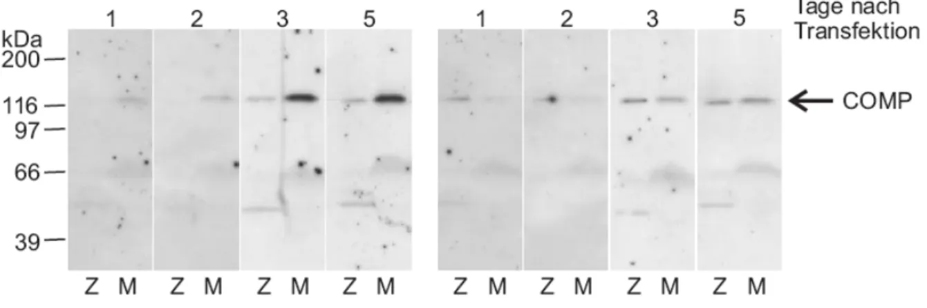 Abb. III 2:   Verteilung von COMP in bovinen Zellen nach Transfektion