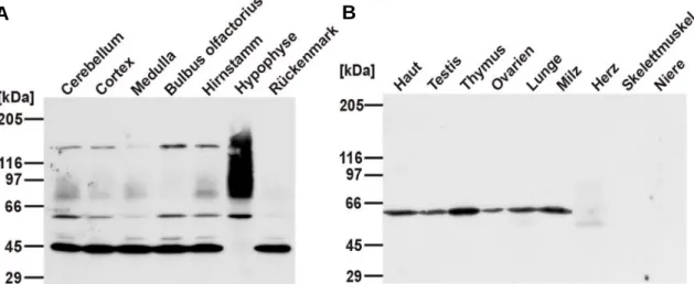 Abb. 2.4: Western-Blot-Analyse verschiedener Gewebeextrakte mit dem affinitätsgereinigten anti-Testi- anti-Testi-can-2-Antikörper 