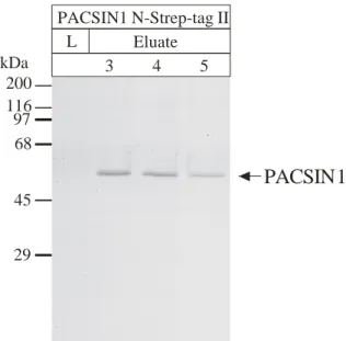 Abb. 17: Reinheitsanalyse der PACSIN1 N-Strep-tag II Eluate.  