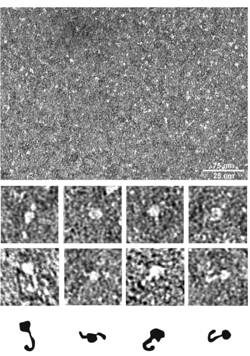 Abb. 3-4: Elektronenmikroskopische Aufnahmen von rekombinant exprimiertem SC1 fl nach Negativ- Negativ-kontrastierung mit Uranylformiat