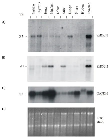 Abbildung 2.9 Northern Blot mit SMOC-1 und SMOC-2 Sonde. mRNA Aliquots von jeweils 5 µg wurden auf  einem 1,2% Agarose Gel unter denaturierenden Bedingungen elektrophoretisch aufgetrennt und auf eine  Nylonmembran geblottet