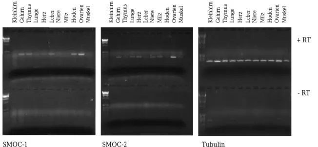 Abbildung 2.11  RT-PCR und Southern-Blot mit  Sonden gegen SMOC-1 und -2. Einer Reaktion mit  Reverser Transkriptase auf Gesamt-RNA  verschie-dener Gewebe folgte eine Amplifikation mittels  PCR mit spezifischen Primern für SMOC-1 bzw