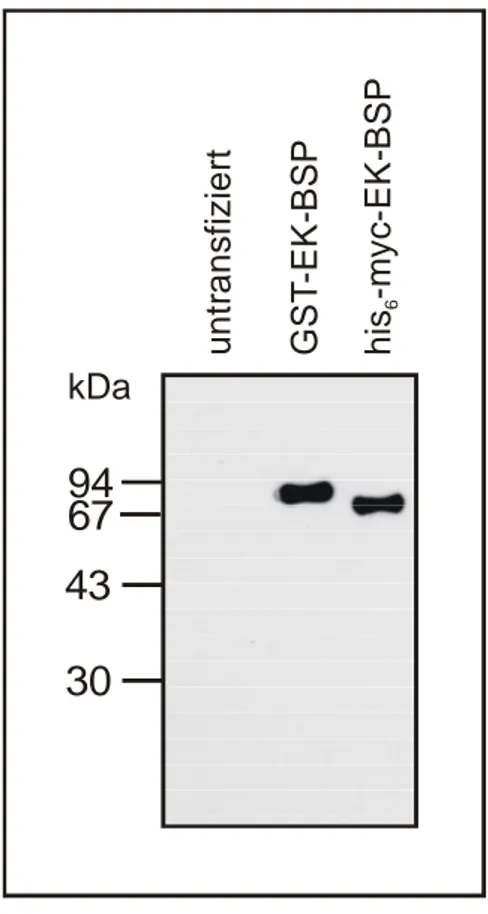 Abb. 6: Serumfreie Zellkulturüberstände transfizierter EBNA-293 Zellen.