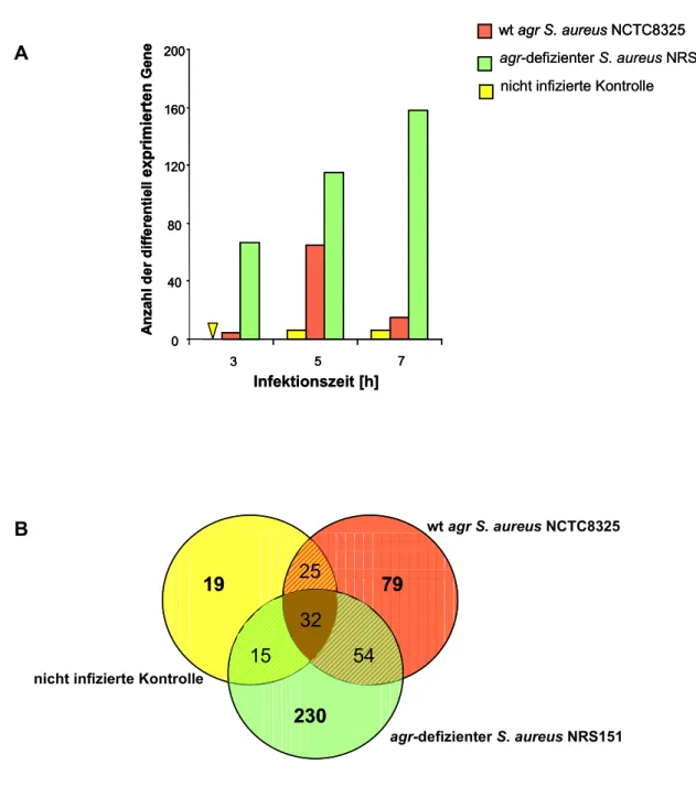 Abb. 7 Änderung der Genexpression in HeLa-Zellen nach Infektion mit den S. aureus Stämmen NCTC8325 und NRS151