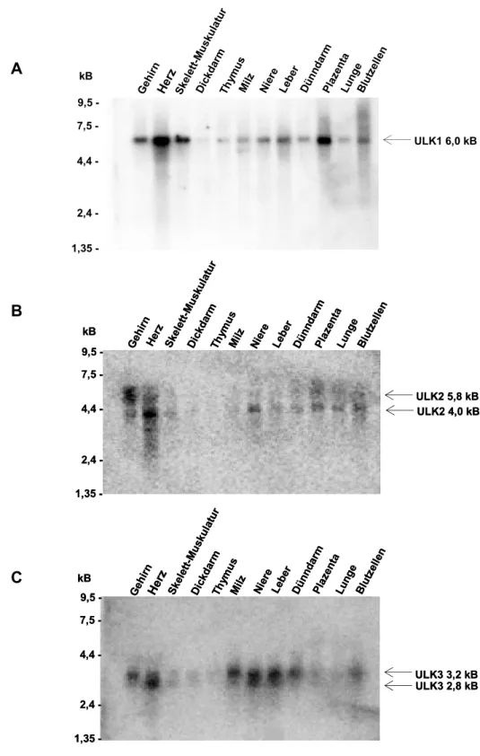 Abb. 10 Nachweis der ULK1-, ULK2- und ULK3-Transkripte in humanen Gewebe durch  Northern Blot Analyse