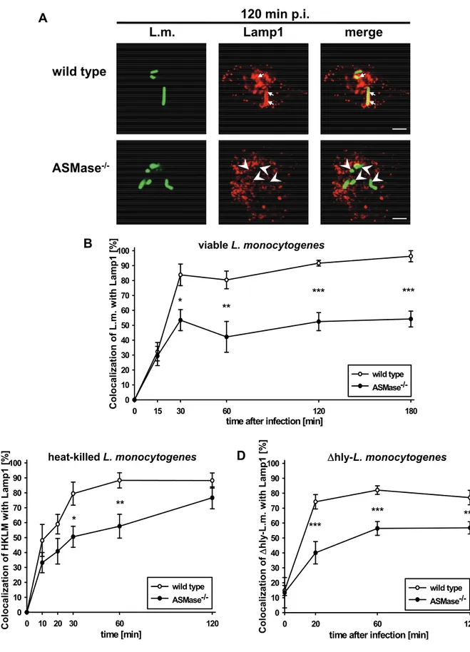 Fig. 4: Reduced colocalization of viable, heat-killed and Δhly-L. monocytogenes with Lamp1 in  ASMase -/-  macrophages