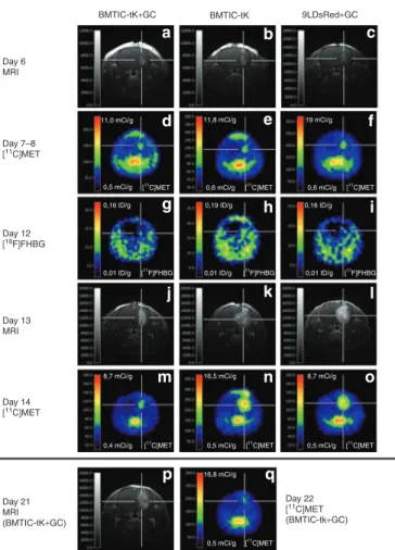 Figure 6  Magnetic resonance imaging (MrI) and positron emission  tomography (Pet) imaging for therapeutic follow-up
