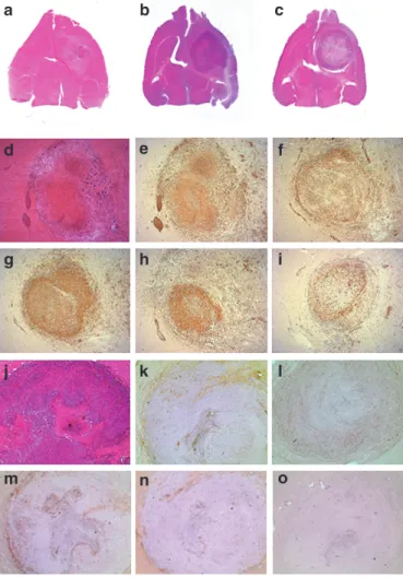 Figure 7  Histology and immunohistochemistry. Animals were killed  and  perfused  when  they  became  terminally  ill  or,  in  the  therapeutic  group, 4–8 days after end of ganciclovir (GC) treatment