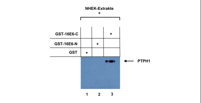 Abb. 11: 16E6 bindet an endogenes PTPH1 aus primären Keratinozyten (NHEK).  