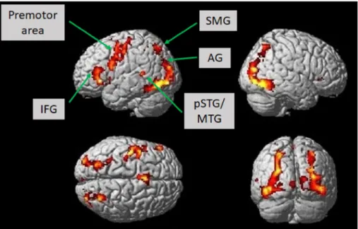 Figure 2. Brain activation in healthy subjects (n = 12) while constructing grammatically and semanti- semanti-cally correct sentences in response to the novel language task, which comprised a combination of picture naming and simple verb generation (T = 7,