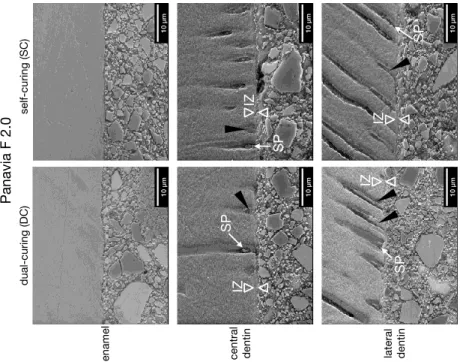 Figure 5. Adhesive interface micromorphology in polished specimens (Experiment 1) after dual- dual-curing or self-dual-curing (original magnification ×6000)
