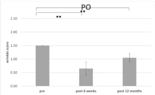 Figure 9. Improvement of the wrinkle severity scale related to the periorbital fold (PO): Comparison of WSS preoperative to 6 weeks and 12 months postoperative (** p &lt; 0.01).