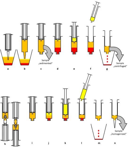 Figure 1. Schematic diagram of the enrichment process. After sedimentation in the suction container (a) lipoaspirate is transferred to a 15 mL double syringe (b)