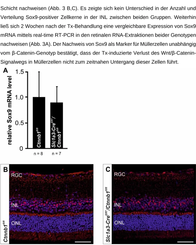Abb. 3: Konditionale β-Catenin Defizienz in Müllerzellen führt nicht zum zeitnahen Untergang der  Müllerzellen