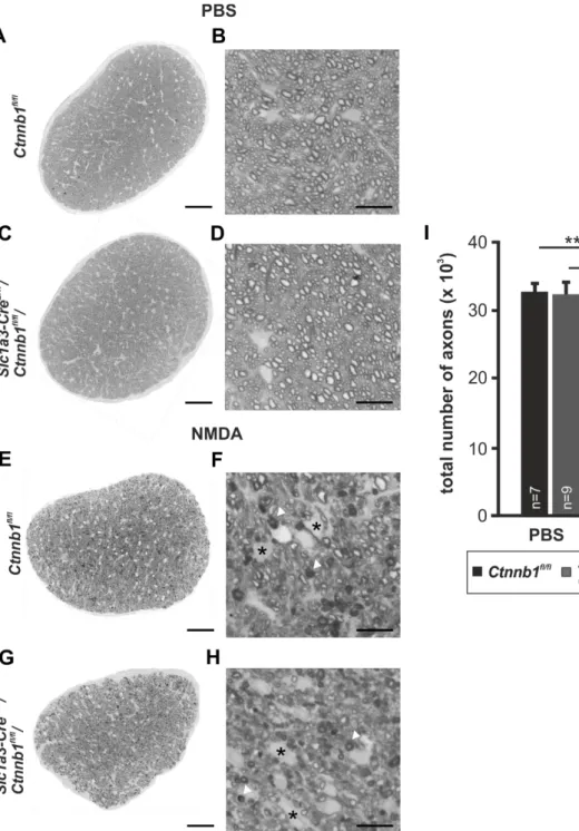Abb. 4: Wnt/β-Catenin-Defizienz in Müllerzellen erhöht den Verlust an Axonen in Sehnerven nach  akutem exzitotoxischem Schaden der RGC